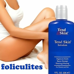 Imagem do Loção Tend Skin Solution Foliculite e Pelos Encravados 236ml