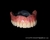 DENTE BIOLUX OMC POSTERIOR SUPERIOR - Dental Nova Era Ltda