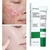 Crema facial acido salicilico BIOAQUA control acné en internet