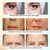 Masajeador Ultrasónico De Radiofrecuencia Facial Rejuvenece - MatSofi Store