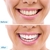 Luz Blanqueador Dental Led Uv Repara Esmalte Dientes Blancos en internet