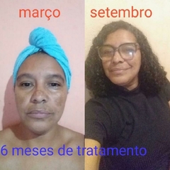 Óleo Facial Revitalizante Rosa Mosqueta na internet