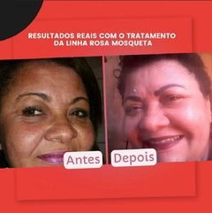 Óleo Facial Revitalizante Rosa Mosqueta - New Connect