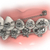 Miniparafuso Extrarradicular de Aço Transm: 4mm Ø2mm Morelli (9875) - comprar online