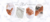 Imagem do banner rotativo Pratas By Diniz