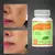 Anti Acne + Vitaminas 60 Cápsulas