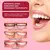 Imagem do Creme dental clareador Sp4 Fórmula suave, sem abrasivos agressivos e com ação anticárie. Clientes relatam melhora na cor dos dentes de forma natural e progressiva!