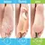 Pés rachados, ásperos e ressecados? Acabe com a pele grossa sem gastar com pedicure toda semana! - Bem Cuidar