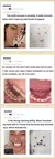 Removedor de tártaro Dentes mais limpos, hálito fresco e sorriso mais branco, sem procedimentos caros.