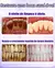 Removedor de tártaro Dentes mais limpos, hálito fresco e sorriso mais branco, sem procedimentos caros. - Bem Cuidar