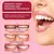 Creme dental clareador Sp4 Fórmula suave, sem abrasivos agressivos e com ação anticárie. Clientes relatam melhora na cor dos dentes de forma natural e progressiva! na internet