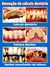 Removedor de tártaro Dentes mais limpos, hálito fresco e sorriso mais branco, sem procedimentos caros. - Bem Cuidar