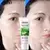 Conheça o Gel Hidratante de Aloe Vera: Hidrata profundamente, acalma irritações e deixa a pele macia e suave!