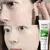 Conheça o Gel Hidratante de Aloe Vera: Hidrata profundamente, acalma irritações e deixa a pele macia e suave! - Bem Cuidar