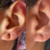 Lobuloplastia Sem Cirurgia na internet