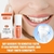 Creme Dental Clareador, Corretor de Cor, Reparador de Esmalte Dental, Sensibilidade Dentes Gengivas - AZDENT BRASIL