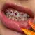 “Joyería Dental Profesional: Guía Completa para Emprender con Estilo” en internet