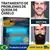 Minoxidil Kirkland 5% 1 frasco 60ml