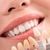 Imagen de 48 Dientes Kit Reparacion Postizo Provisorio Protesis Moldea