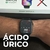 Imagem do Smartwatch W10 com chat GPT em Português e 1GB