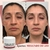 Realce a beleza natural da sua pele com o Creme Clareador e Anti-Sardas! - comprar online