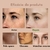 Creme Facial Removedor de Melasma e Manchas Escuras | Clareador, Hidratante e Rejuvenescedor – 15ml - Shopolis