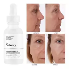 Imagen de THE ORDINARY Hyaluronic Acid 2% + B5 Serum