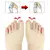 Separador de dedos dos pés, corretor de joanete, hálux valgus, ortopédicos, a - comprar online