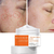 30ml cremes de dia de clareamento intensivo hidratantes ácido tranexâmico inibir melanina clareia manchas escuras teimosas 30g - comprar online
