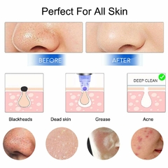 Removedor de Puntos Negros. Limpieza Profunda y Cuidado Facial en internet