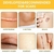 Imagen de Cinta Silicona Cicatrizante Reduce Cicatriz Facial Corporal