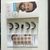FFOrder Nasal Breathing Dilator - buy online