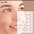 Parches para acne