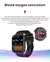 Imagem do Xiaomi smartwatch bluetooth, carregamento sem fio