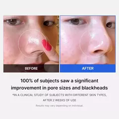 Medicube Zero Pore Pads na internet