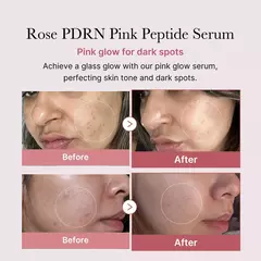 PDRN Pink Peptide Serum na internet