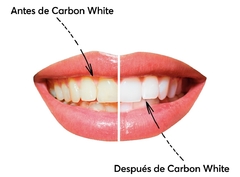 Carbón Activado de Coco – Blanqueador Dental Natural