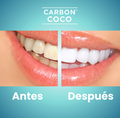 Carbón Activado de Coco – Blanqueador Dental Natural - Solleva