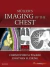 Muller's Imaging of the Chest
