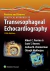 Perrino and Reeves' Practical Approach to Transesophageal Echocardiography