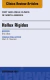 Hallux Rigidus, An Issue of Foot and Ankle Clinics of North America