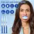 Kit de clareamento dos dentes pap 18% 35% peróxido - comprar online