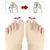 Imagem do Separador Toe, hálux valgo, corrector joanete, órteses, osso, ajustador polega