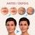 Adesivos Anti Rugas para Rosto Modelo:9 Peças - loja online