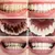 Creme dental - Ferramenta de clareamento hálito fresco na internet