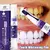 Kit Dentes branqueamento creme dental caneta remover manchas de placa limpeza hi na internet