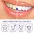 Kit Dentes branqueamento creme dental caneta remover manchas de placa limpeza hi - Kubo Shop