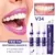 Kit Dentes branqueamento creme dental caneta remover manchas de placa limpeza hi na internet