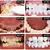 Imagem do V34 roxo dentes branqueamento creme dental remover manchas de placa limpeza higiene oral ferramentas de lixívia dental respiração fresca beleza saúde