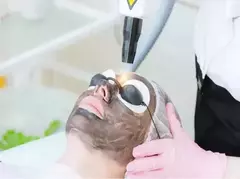 LASER REMOÇÃO DE TATUAGEM E MICROPIGMENTAÇÃO | MÁQUINA DESPIGMENTADORA PROFISSIONAL - HF - House Farma